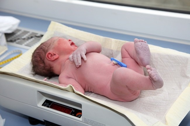 Ujian Skor Apgar Untuk Memeriksa Keadaan Bayi Baru Lahir