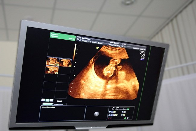 2 Aylık Hamile: Embriyodan Fetüse