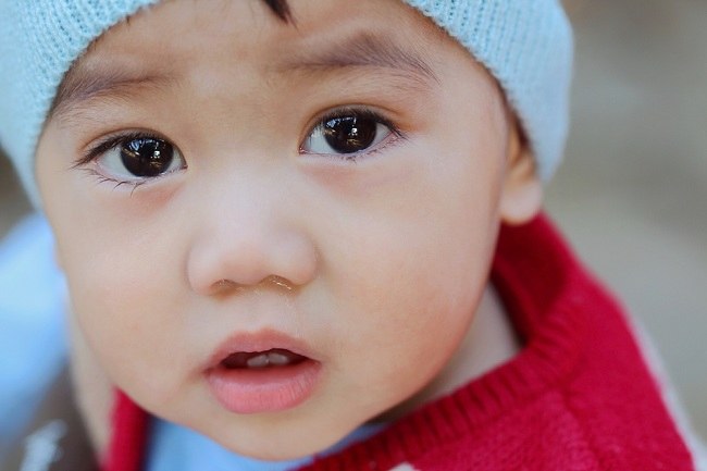 Yang Perlu Anda Ketahui Mengenai Mata Baby Belekan