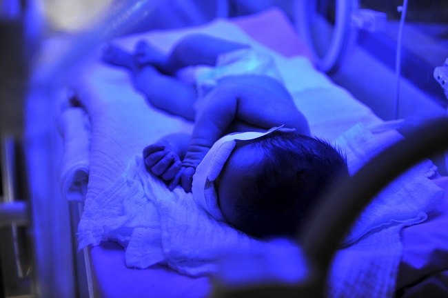 Разпознайте нормалните нива на билирубин при новородени