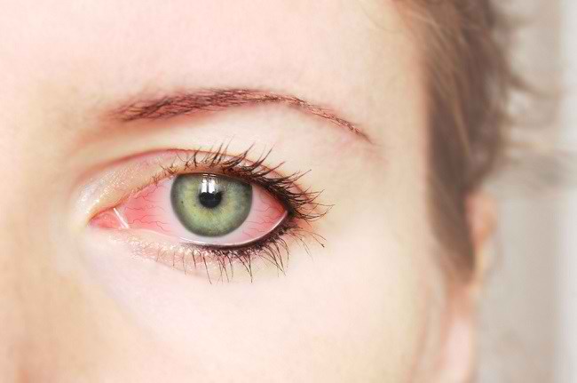 Различни начини за преодоляване на червените очи