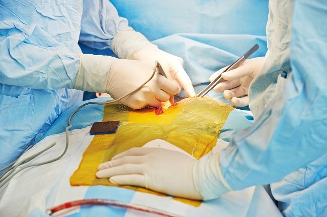 Процес и рискове при трансплантация на сърце