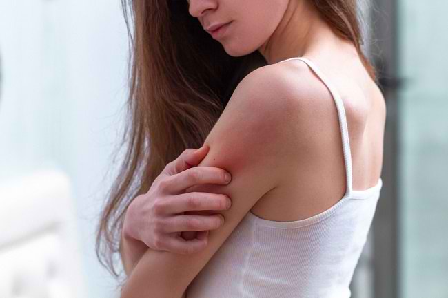 احذر من حكة الجلد يمكن أن تكون علامة على مرض خطير
